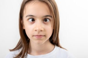 misaligned eyes in child